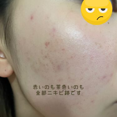 スキンケア方法 化粧水 敏感肌用 高保湿タイプ 無印良品の使い方 効果 はじめましてこんばんは By Teika 混合肌 10代前半 Lips