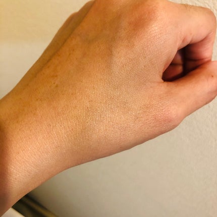 ダーマレーザー ウルセラR/クオリティファースト/美容液を使ったクチコミ(5枚目)