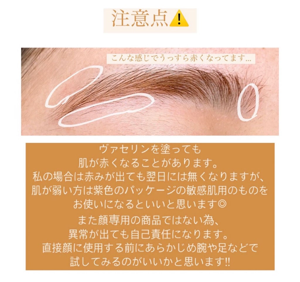 脱色クリーム スピーディー/エピラット/ムダ毛ケアを使ったクチコミ(8枚目)