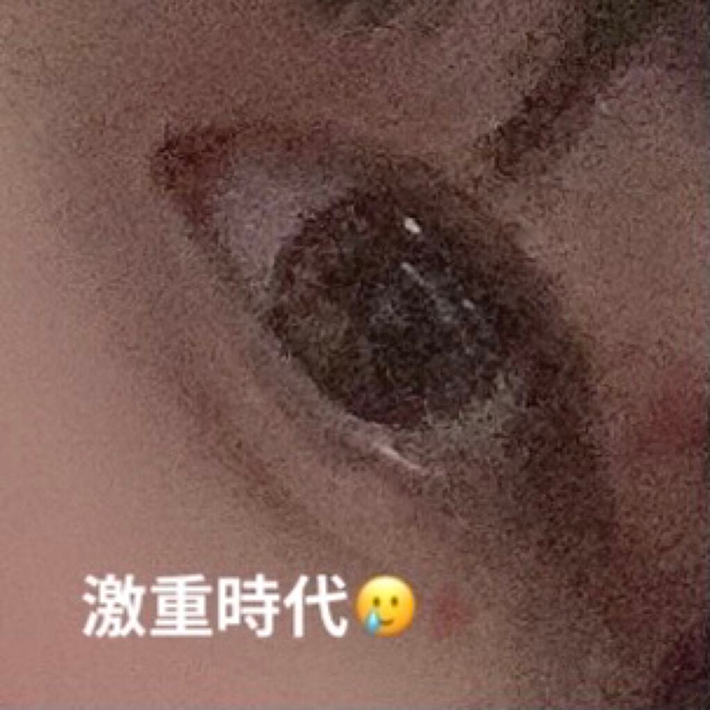 秘かに二重!極細両面二重テープ 日本製/セイワ・プロ/二重まぶた用アイテムを使ったクチコミ(2枚目)