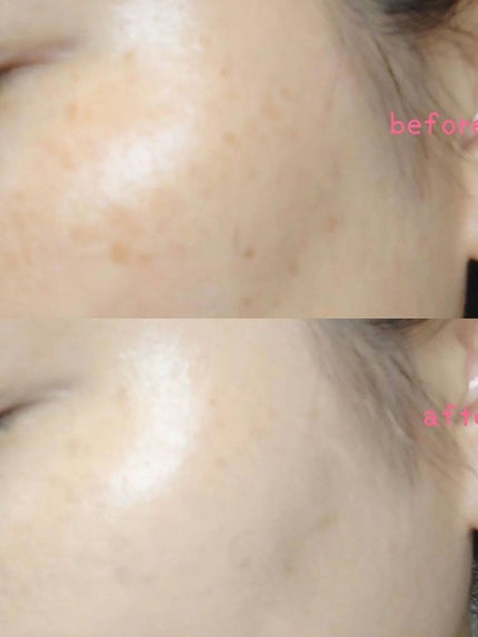 セラムクッションファンデーション SPF20・PA++/B.A/クッションファンデーションを使ったクチコミ(7枚目)