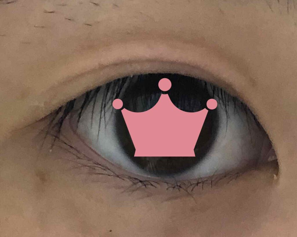 アイビューティー フィクサー WP/アストレア ヴィルゴ/二重まぶた用アイテムを使ったクチコミ(1枚目)