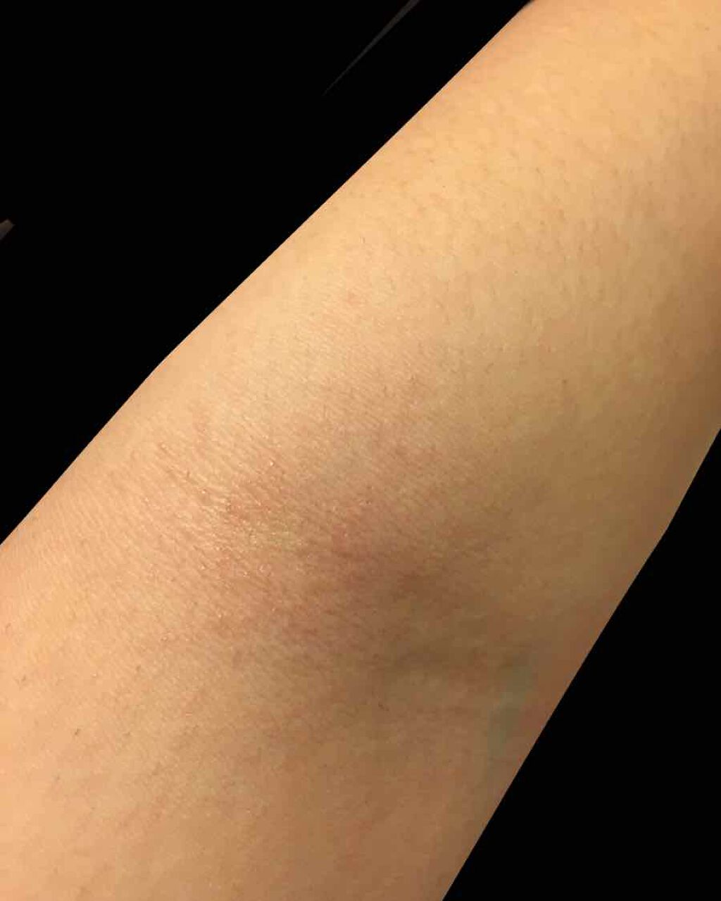 ハトムギ化粧水(ナチュリエ スキンコンディショナー R )/ナチュリエ/化粧水を使ったクチコミ(4枚目)