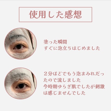 ミミチュールインスパイア ミー!バブル パック/クラブ/洗い流すパック・マスクを使ったクチコミ(3枚目)