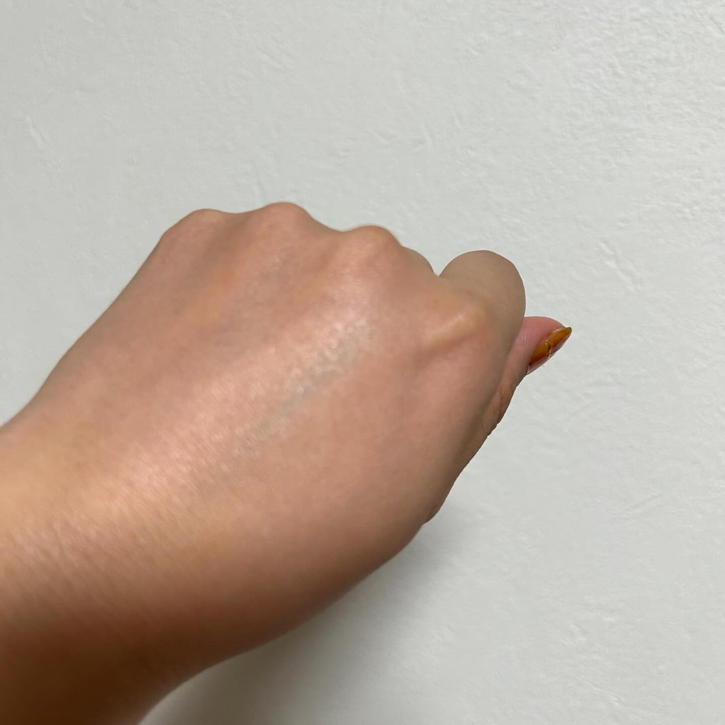 SKIO VCトライアルセット/SKIO/トライアルキットを使ったクチコミ(9枚目)