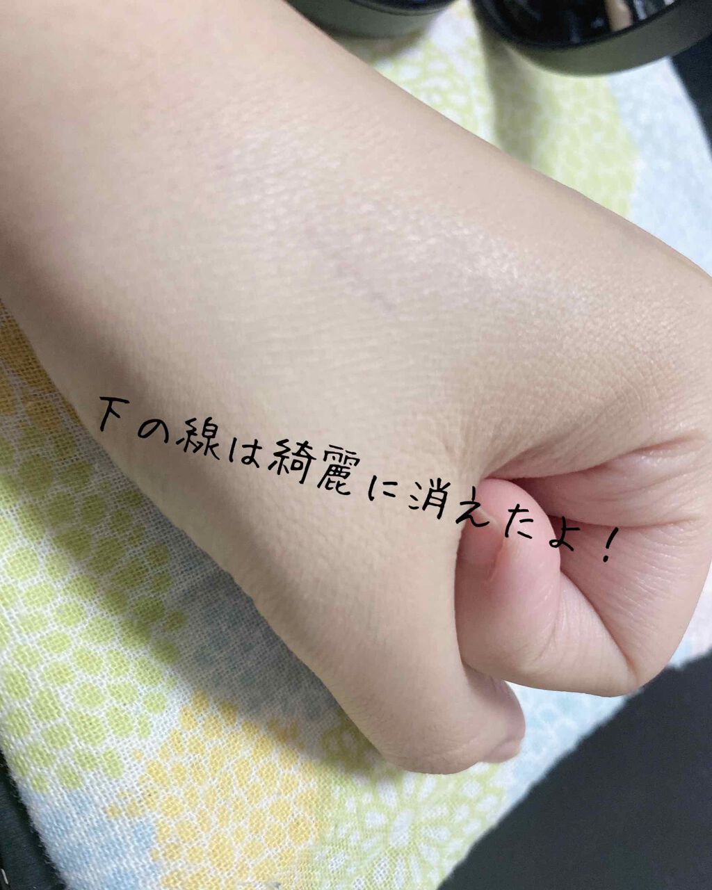 キル カバー ファンウェア クッション エックスピー/CLIO/クッションファンデーションを使ったクチコミ(4枚目)