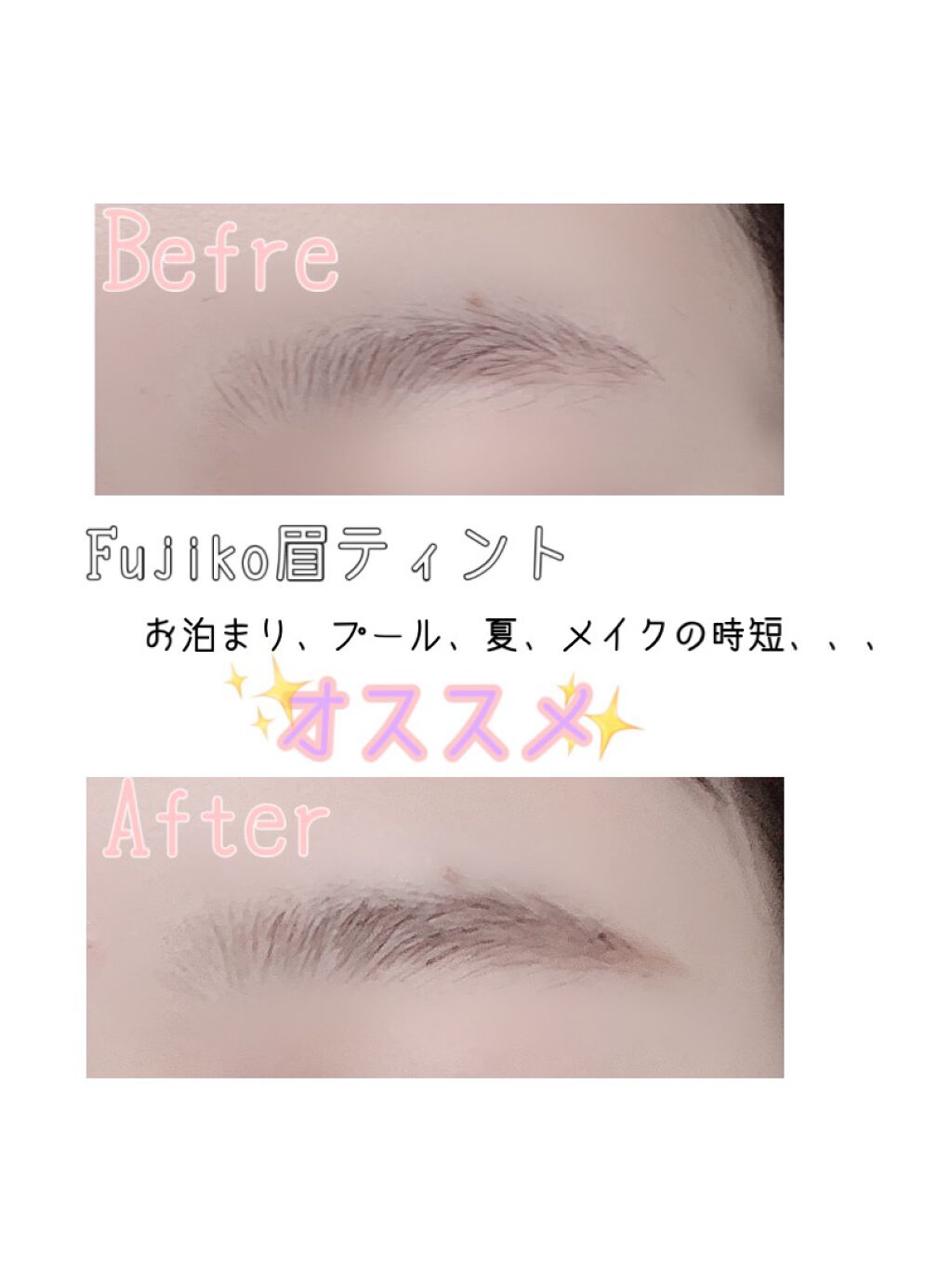 bi-hada ompa L ホルダー替刃2個付/貝印/シェーバーを使ったクチコミ（1枚目）