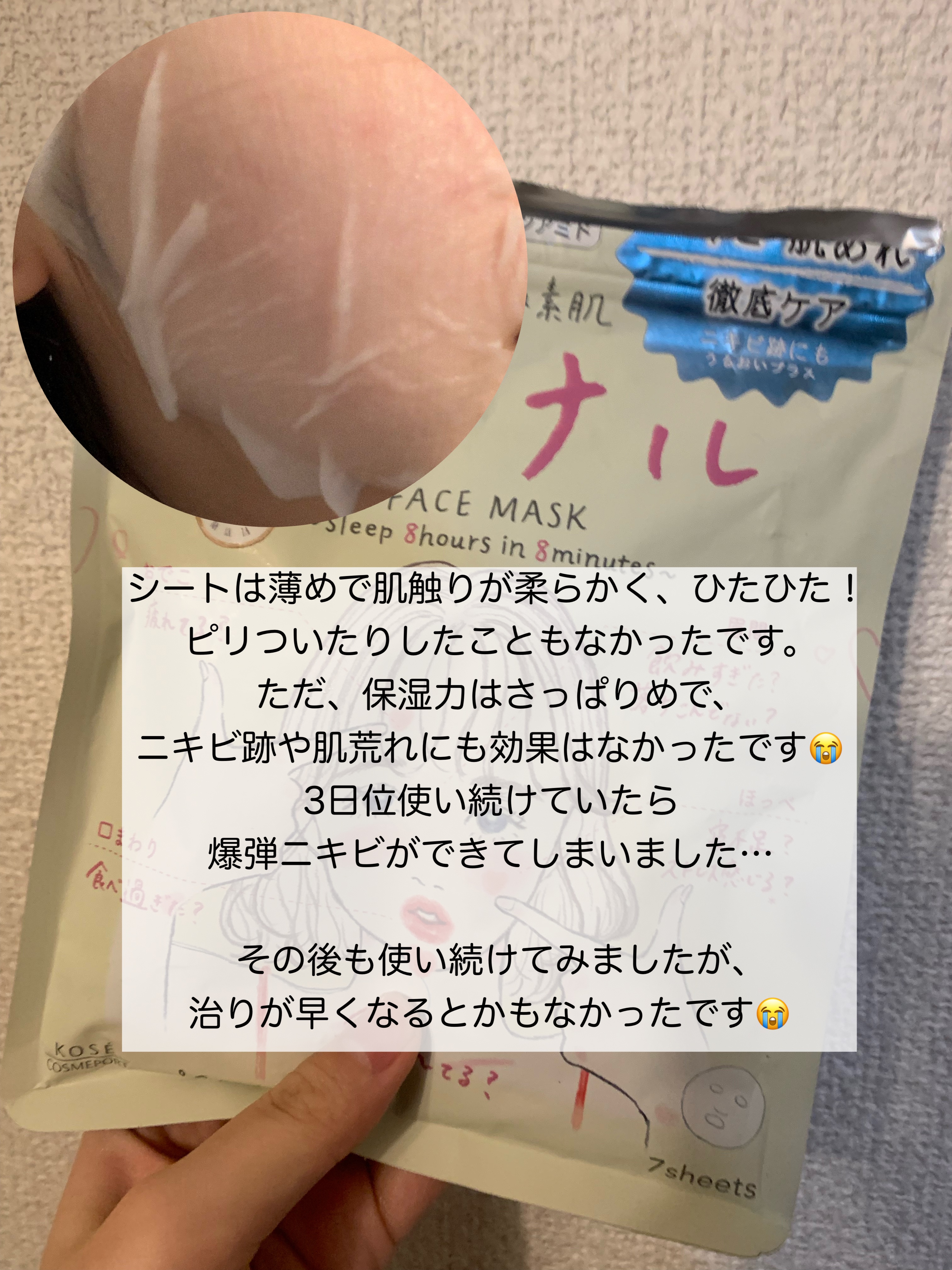 ごめんね素肌 キニナルマスク/クリアターン/シートマスク・パックを使ったクチコミ（3枚目）