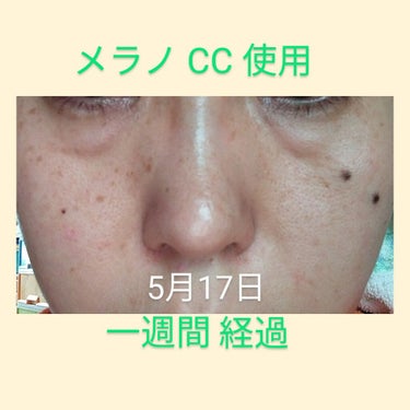 伊菜夏(いなか) ※ 体調不良でお休み中 on LIPS 「メラノCCを使い始めて一週間経過しました。鼻まわりや頬骨辺りの..」（4枚目）