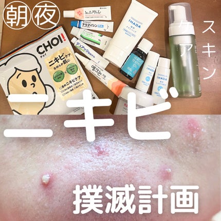 テラマイシン 軟膏(医薬品)/ジョンソン・エンド・ジョンソン/その他を使ったクチコミ(1枚目)