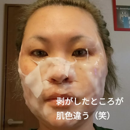 グローパックCL+/enisie/シートマスク・パックを使ったクチコミ(6枚目)