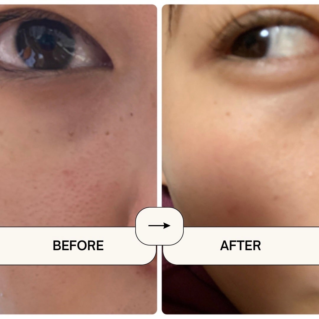 エンハンサー/ニュースキン/美容液を使ったクチコミ(1枚目)