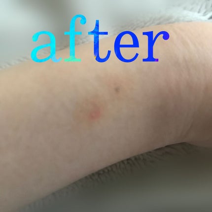 カバーパーフェクション チップコンシーラー/the SAEM/リキッドコンシーラーを使ったクチコミ(3枚目)