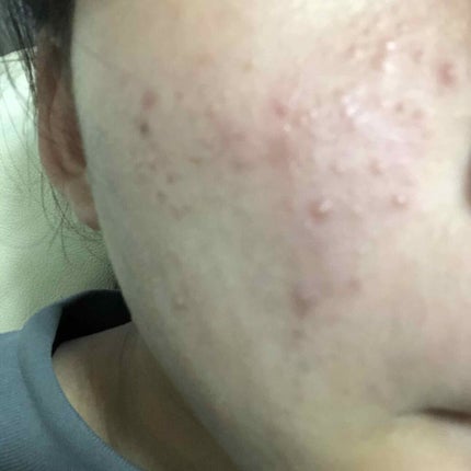 を使ったクチコミ(2枚目)