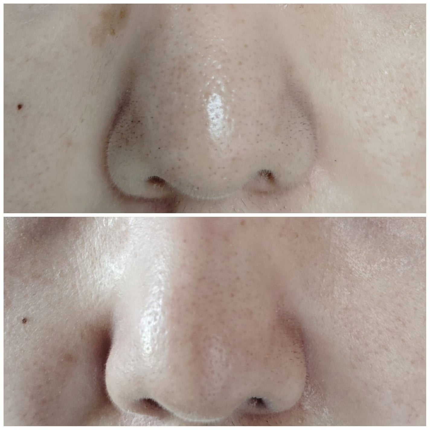 ゼロ毛穴クレイパック/MEDICUBE/洗い流すパック・マスクを使ったクチコミ(4枚目)