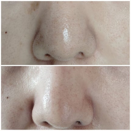 ゼロ毛穴クレイパック/MEDICUBE/洗い流すパック・マスクを使ったクチコミ(4枚目)