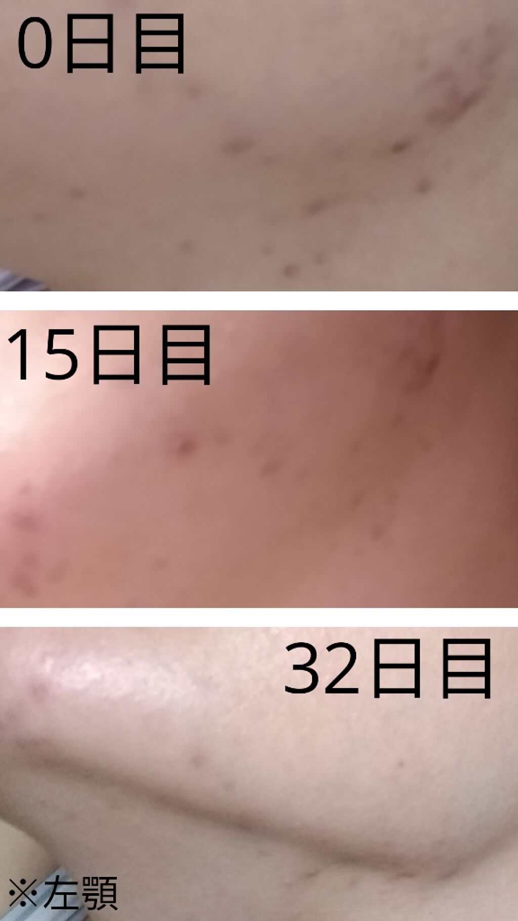 チョコラBBドリンクビット（医薬品）/チョコラBB/その他を使ったクチコミ（2枚目）