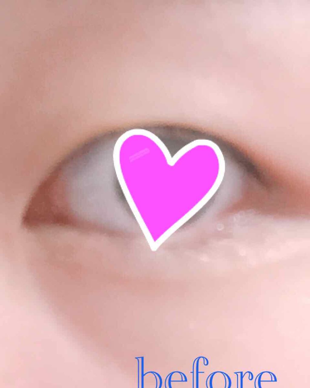 ハイブリッドフィルム/アイトーク/二重まぶた用アイテムを使ったクチコミ(2枚目)