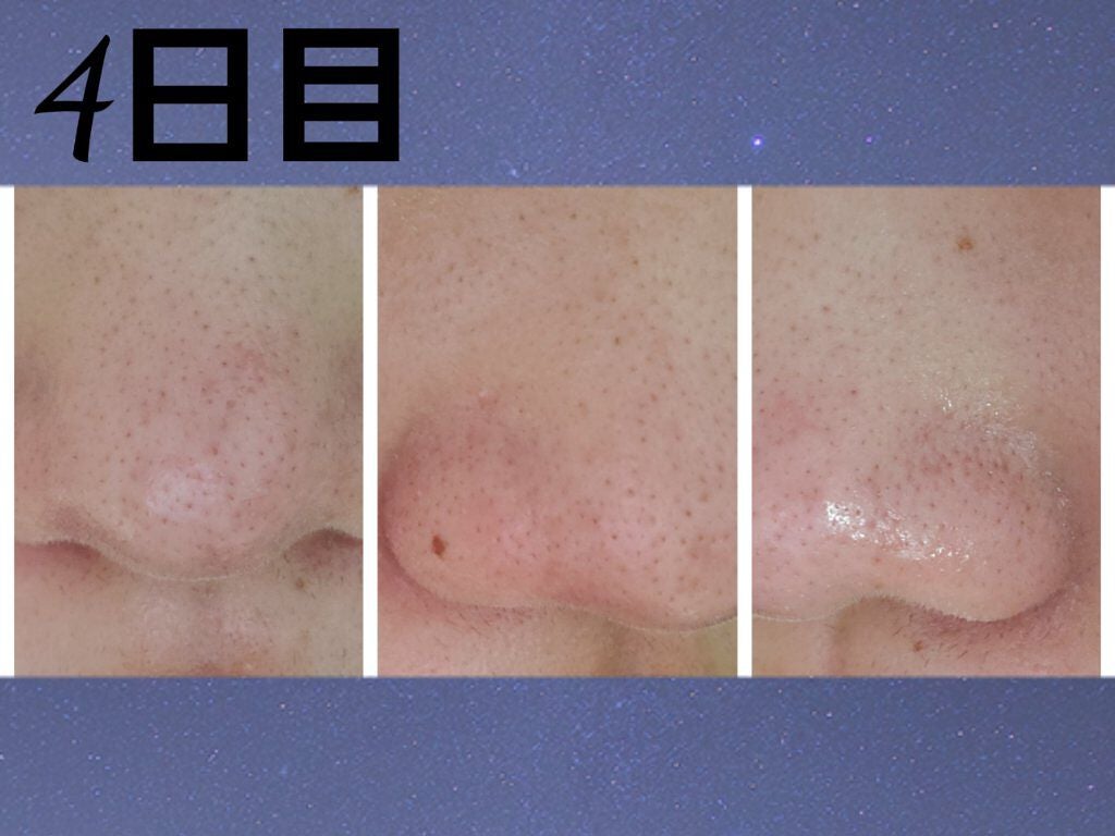 お米のマスク/毛穴撫子/シートマスク・パックを使ったクチコミ(8枚目)