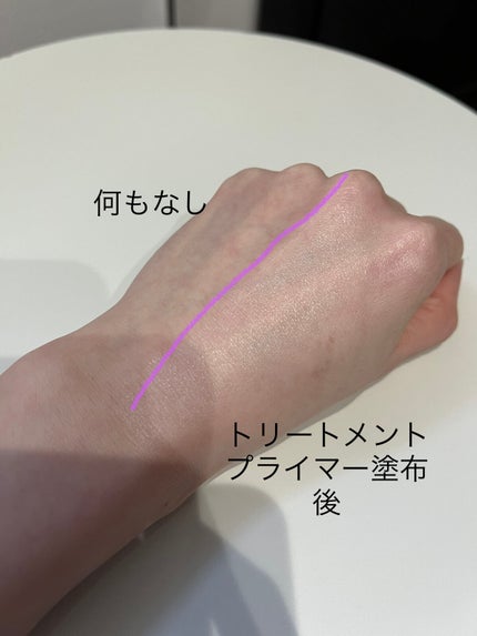 オルビスユー トリートメントプライマー/オルビス/化粧下地を使ったクチコミ(4枚目)