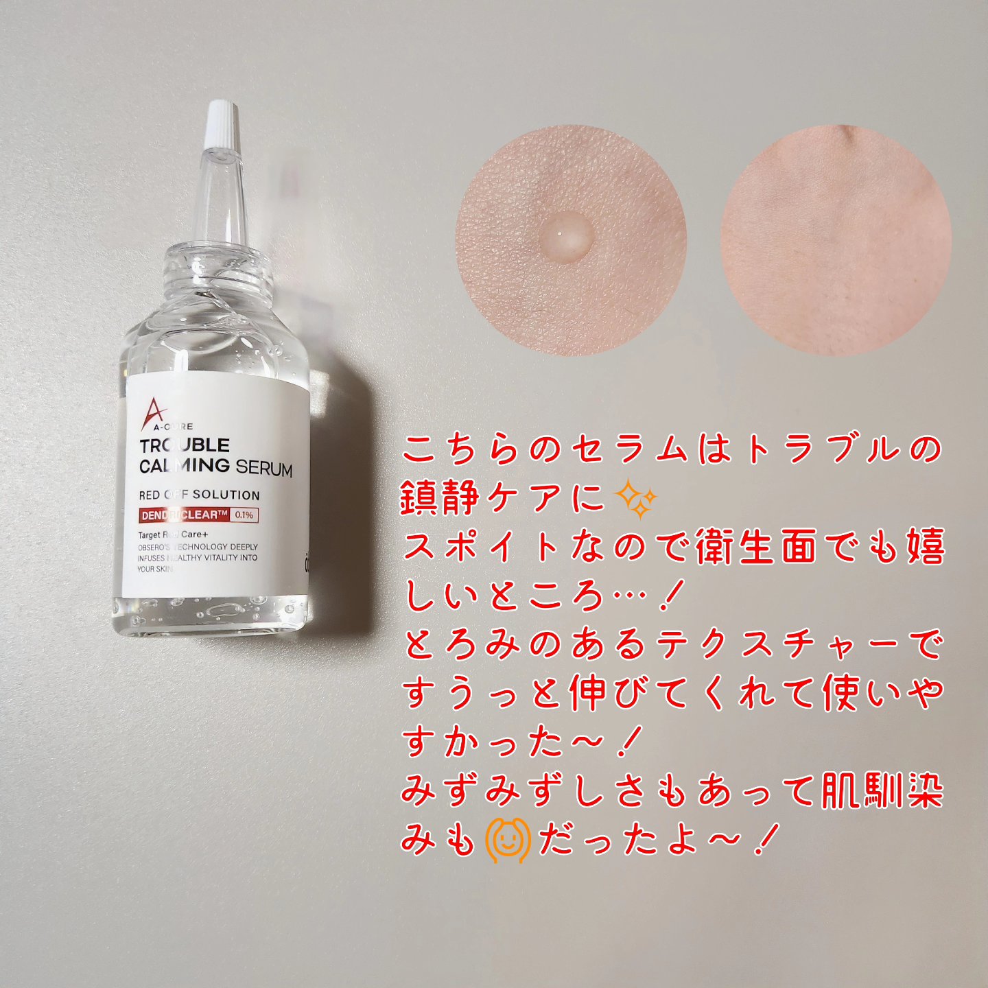 エーキュアスピキュールクリーム/obsero/フェイスクリームを使ったクチコミ（2枚目）