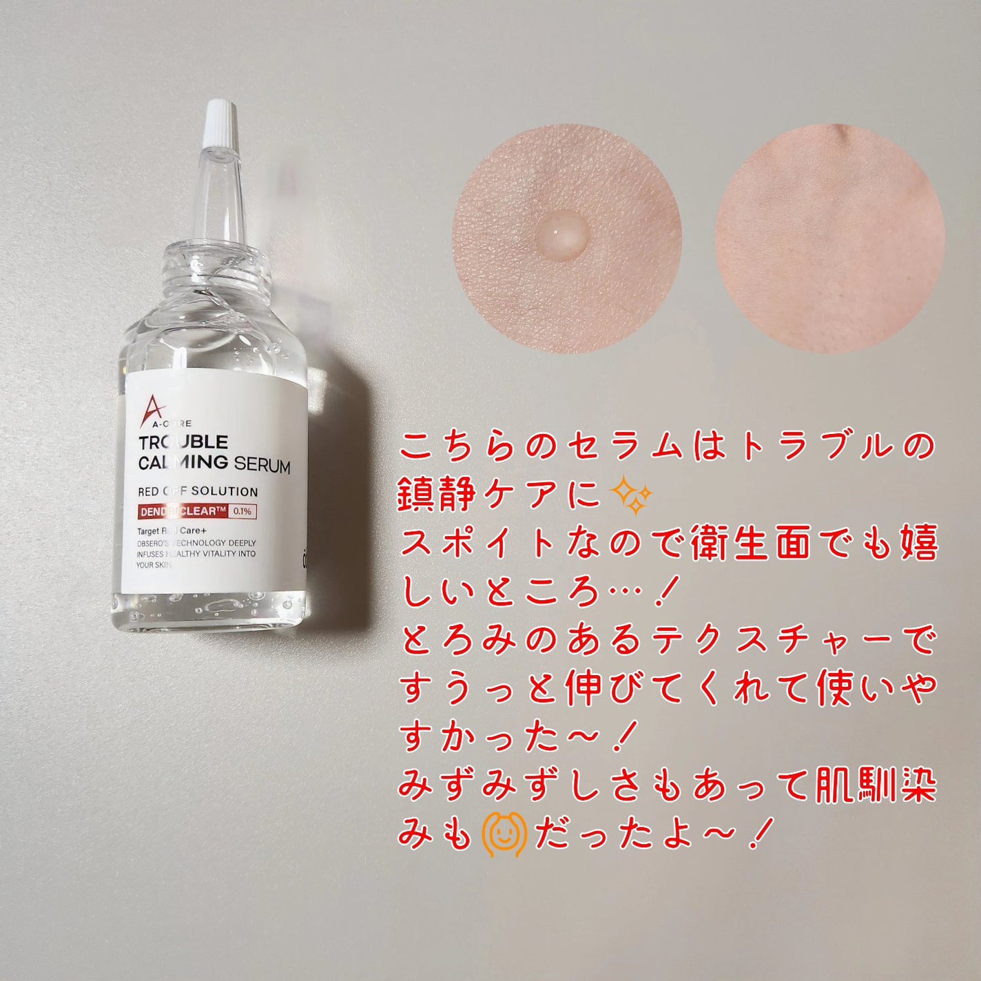 エーキュアトラブルカーミングセラム/obsero/美容液を使ったクチコミ(2枚目)