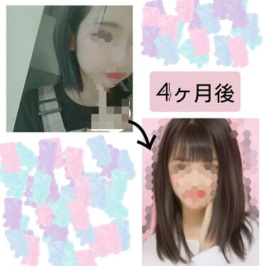 亜鉛 30日分 栄養機能食品 亜鉛 Dhcを使った口コミ ヘアアクセルレーター 亜鉛 髪を早く伸 By Yuka 普通肌 10代前半 Lips