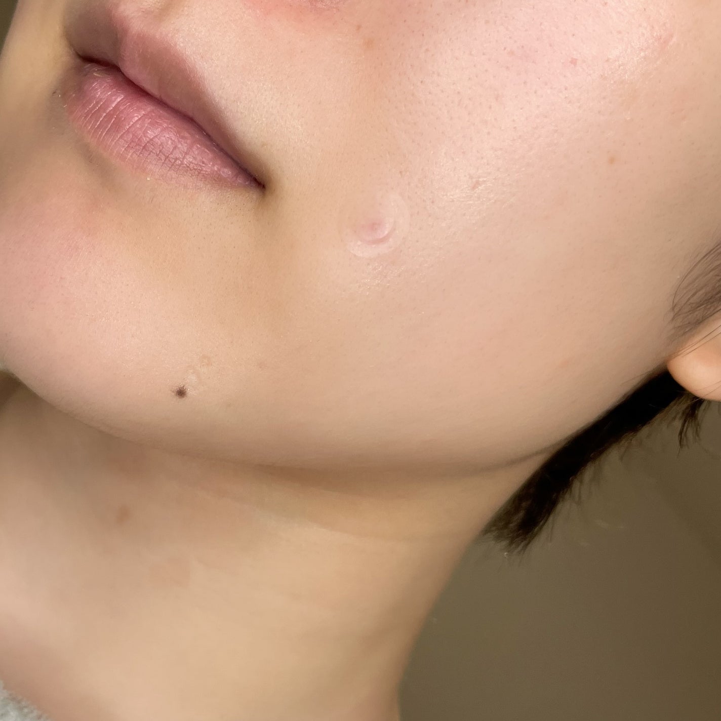 キャッチミーパッチ/CATCH ME PATCH/にきびパッチを使ったクチコミ(5枚目)