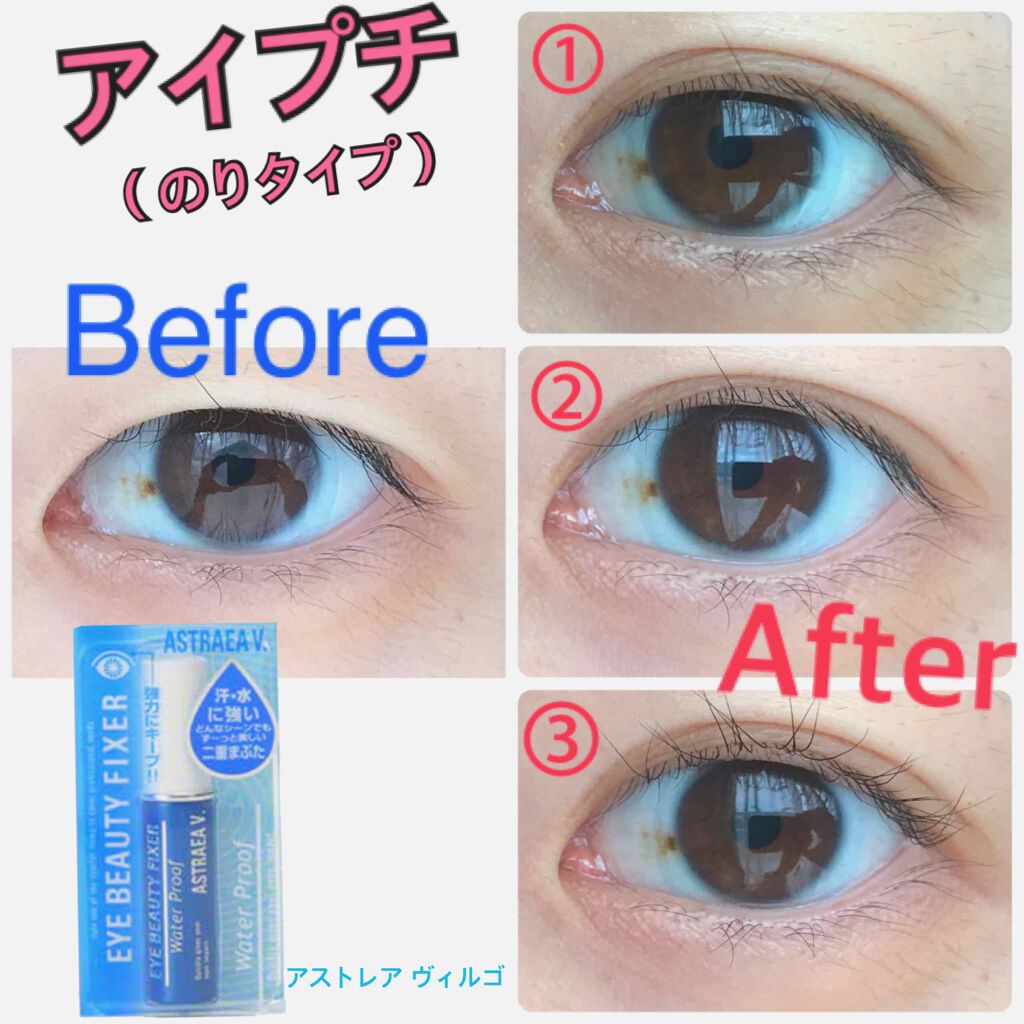 アイビューティー フィクサー WP/アストレア ヴィルゴ/二重まぶた用アイテムを使ったクチコミ(1枚目)
