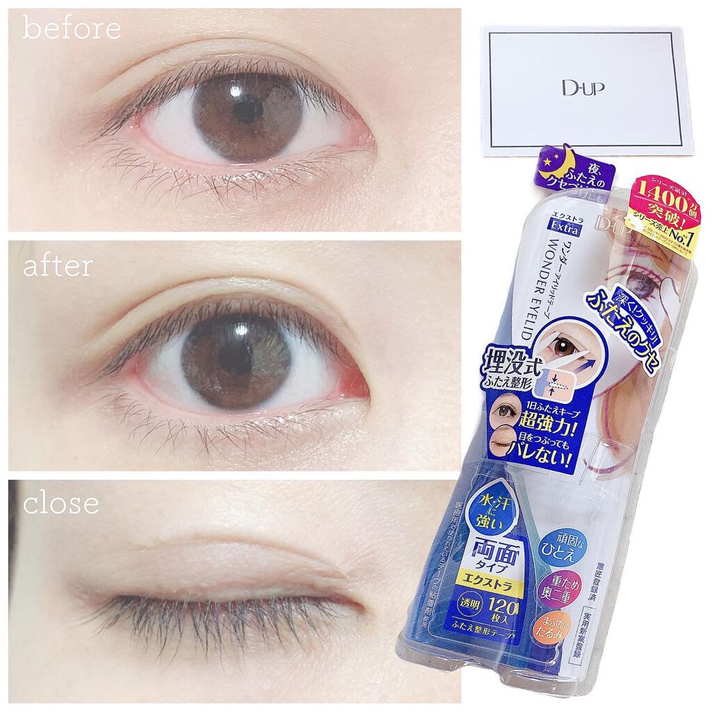 ワンダーアイリッドテープ Extra/D-UP/二重まぶた用アイテムを使ったクチコミ(1枚目)