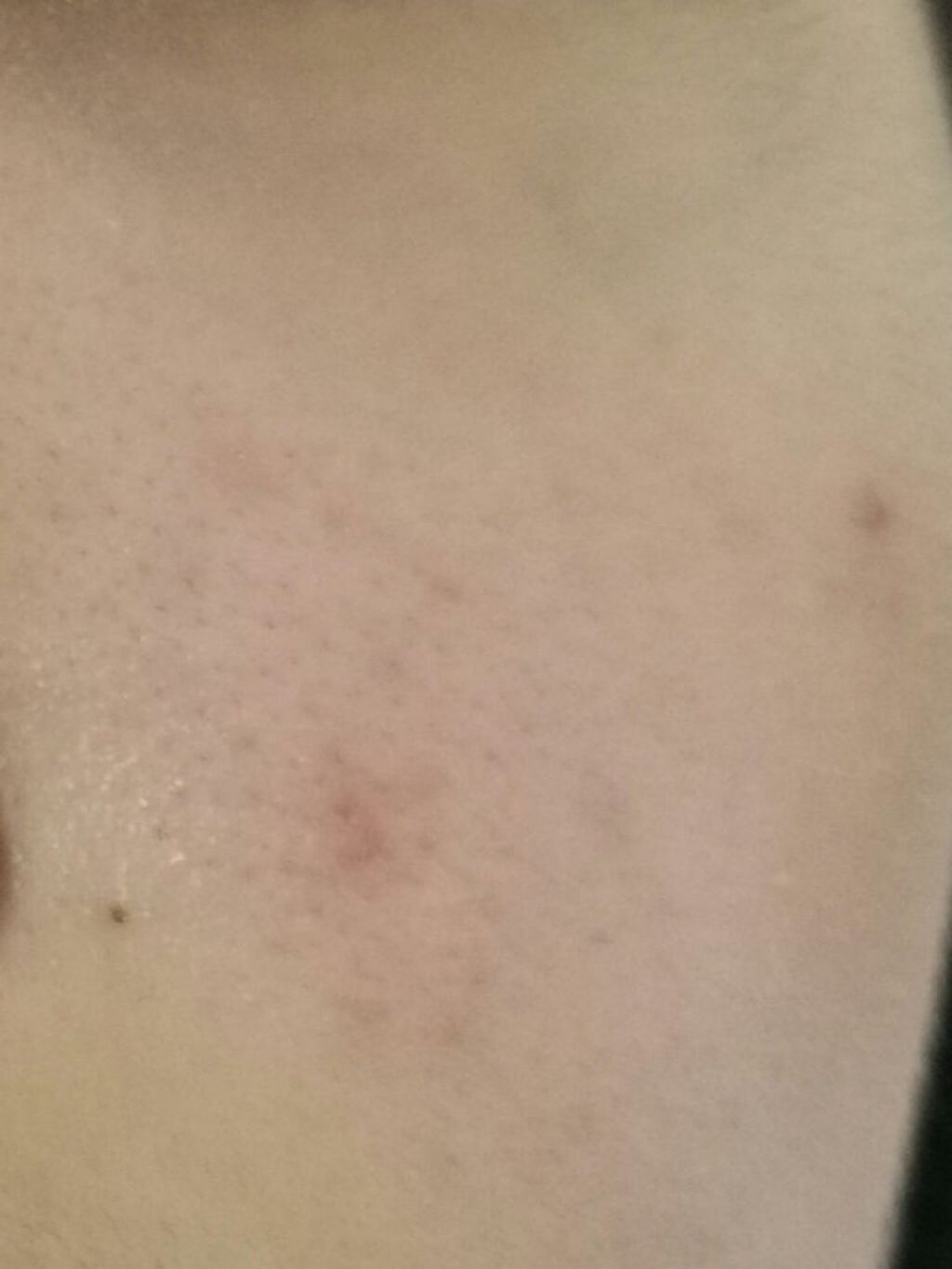 ハトムギ保湿ジェル(ナチュリエ スキンコンディショニングジェル)/ナチュリエ/美容液を使ったクチコミ（3枚目）