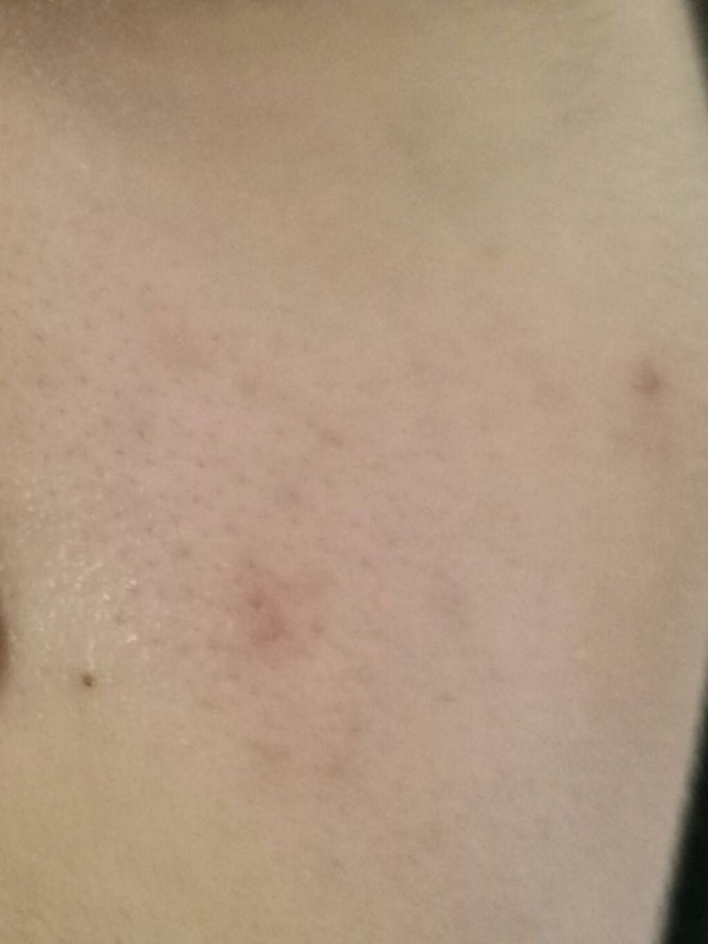 ハトムギ保湿ジェル(ナチュリエ スキンコンディショニングジェル)/ナチュリエ/美容液を使ったクチコミ(3枚目)