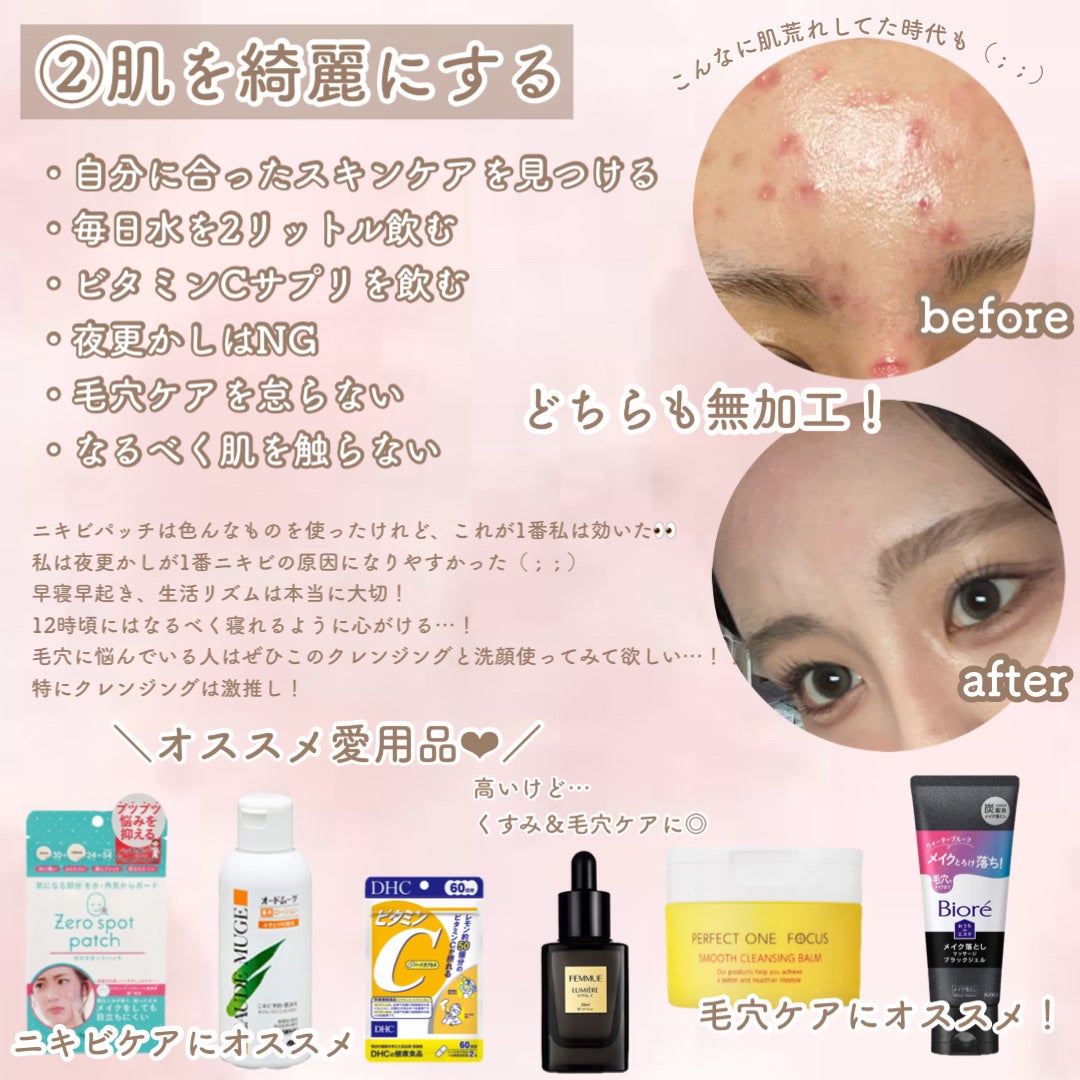 オードムーゲ 薬用ローション(ふきとり化粧水)/オードムーゲ/拭き取り化粧水を使ったクチコミ(3枚目)