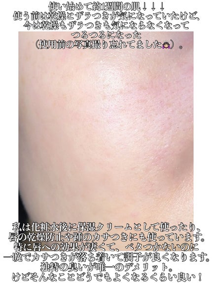 シアバター・未精製・オーガニック/マンデイムーン/フェイスバームを使ったクチコミ(4枚目)