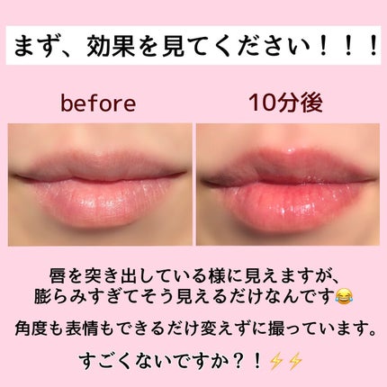 KAREN/パーソナルカラーアナリスト on LIPS 「中顔面短縮の為に探していたプランパー。今のところこれが最強です..」(2枚目)