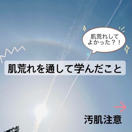 ゆき on LIPS 「私は今もそうですが、ずっとマスク生活での肌荒れやそこからのスト..」(1枚目)
