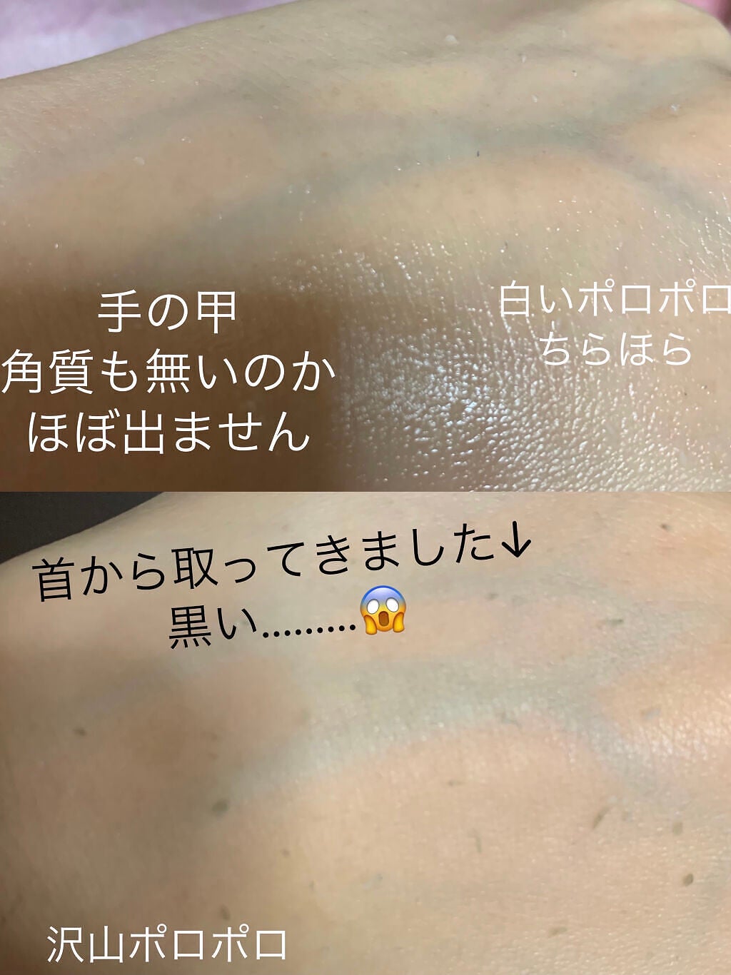 フェイシャルマイルドピーリング/primera/ピーリングを使ったクチコミ(2枚目)