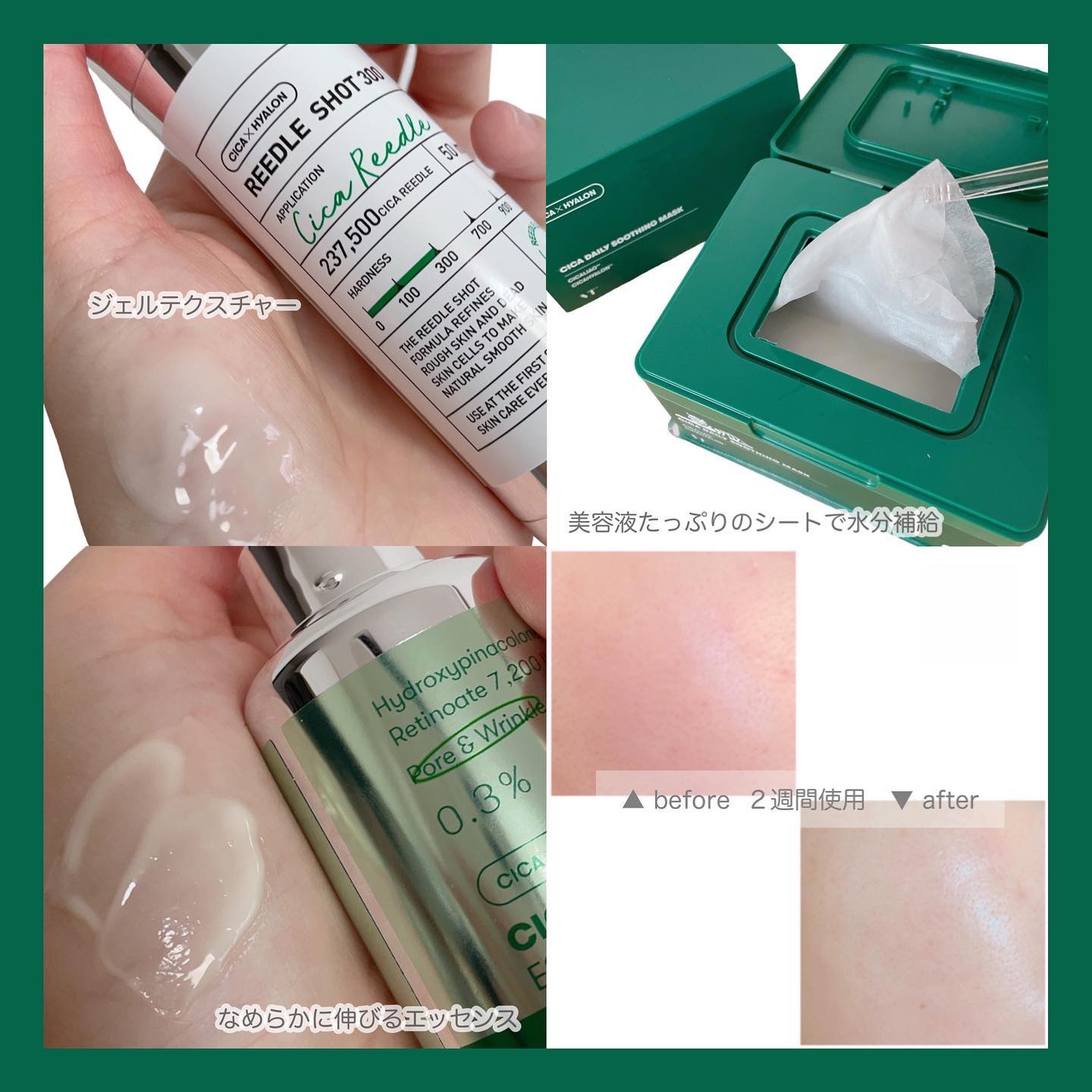 CICA デイリースージングマスク/VT/シートマスク・パックを使ったクチコミ（3枚目）