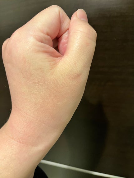 えり0225 on LIPS 「【使った商品】・センテラクイックカーミングパット 70枚・セン..」(5枚目)