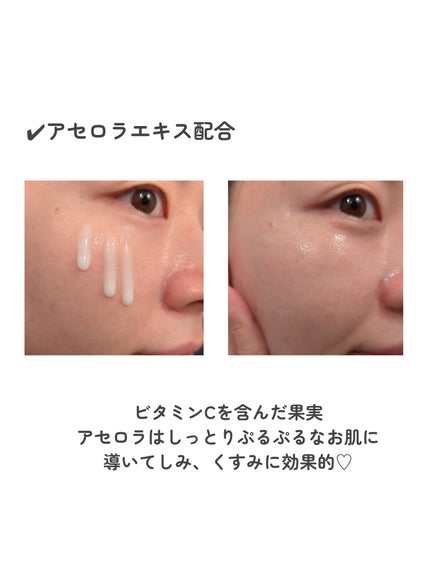 MELALESS AMPOULE/WONJIN EFFECT/美容液を使ったクチコミ(5枚目)