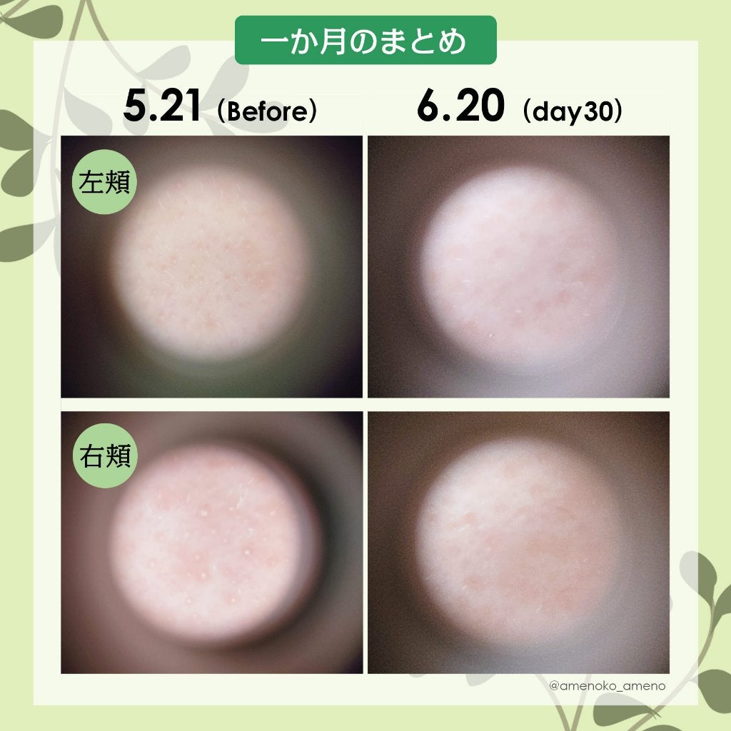 CICA クリーム/VT/フェイスクリームを使ったクチコミ(7枚目)