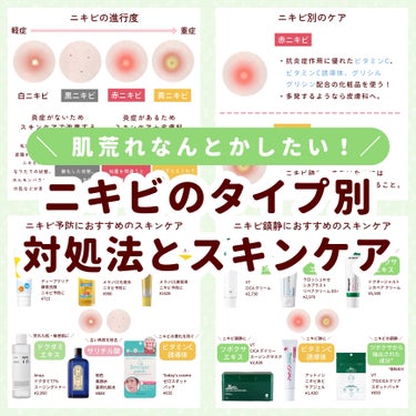 メラノCC 薬用しみ対策 美白化粧水のクチコミ「

　＼ ニキビのタイプ別ケアまとめ ／


　ニキビは「色」によって

　合うスキンケアや対.....」（1枚目）