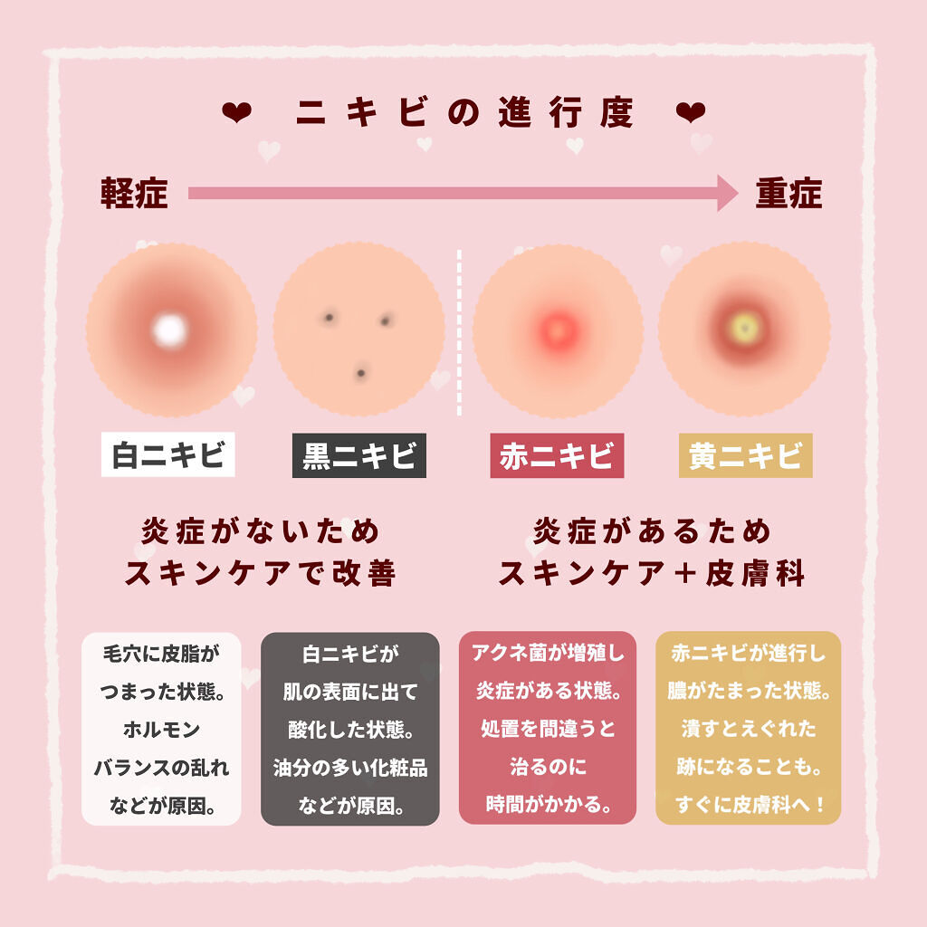 明色美顔水 薬用化粧水/美顔/化粧水を使ったクチコミ（2枚目）