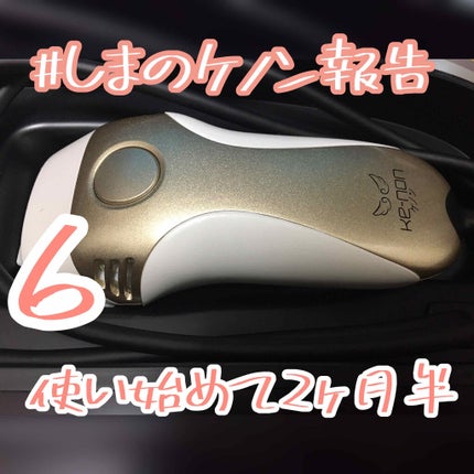 光美容器KE-NON(ケノン)/エムテック/家庭用脱毛器を使ったクチコミ(1枚目)
