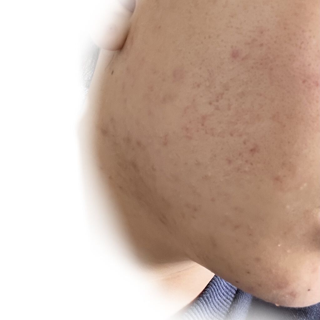 乳液・敏感肌用・高保湿タイプ/無印良品/乳液を使ったクチコミ（2枚目）