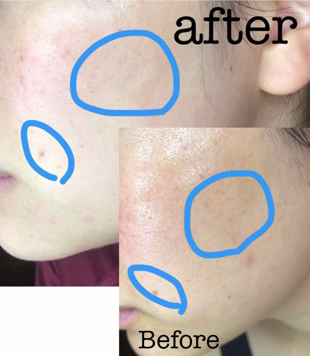 ホワイトラッシュ/アンドシーム/フェイスクリームを使ったクチコミ(4枚目)