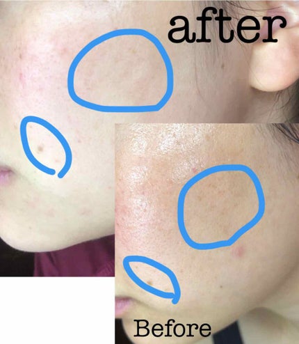 ホワイトラッシュ/アンドシーム/フェイスクリームを使ったクチコミ(4枚目)