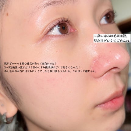 ゼロ毛穴クレイパック/MEDICUBE/洗い流すパック・マスクを使ったクチコミ(5枚目)