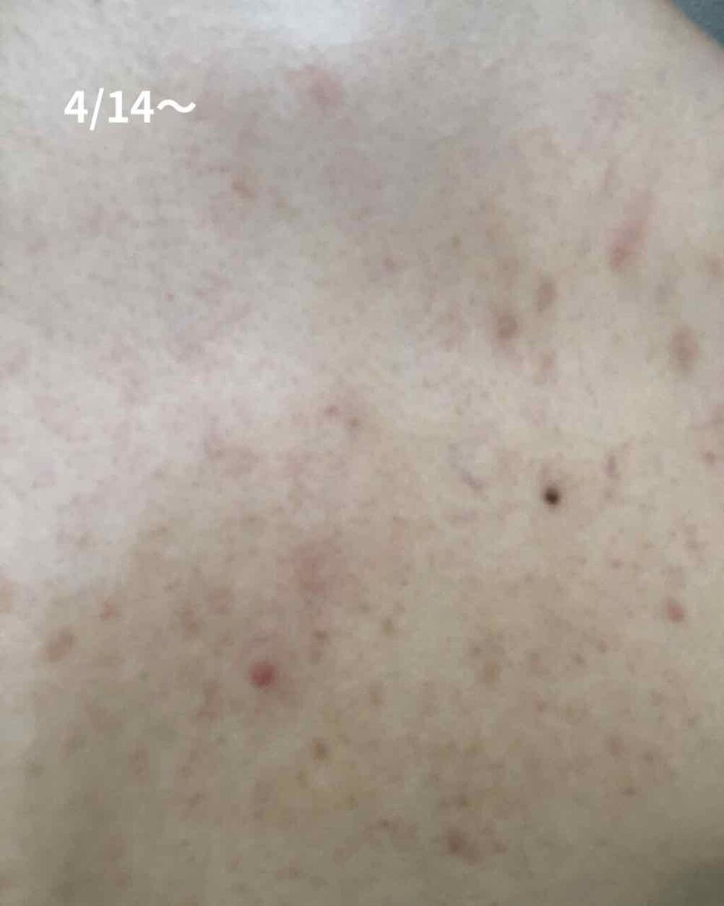 EclatCharme(エクラシャルム)/FABIUS/オールインワン化粧品を使ったクチコミ(3枚目)