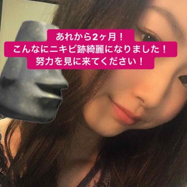 彩花 on LIPS 「1枚目はSODAで撮ったので加工ありです🤒2枚目は無加工のカメ..」（1枚目）